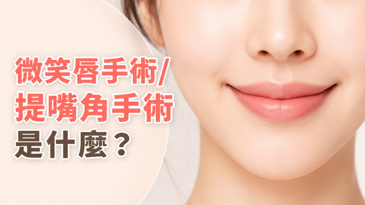 微笑唇手術是什麼